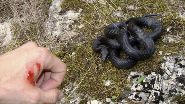 טופל בחדר החייאה