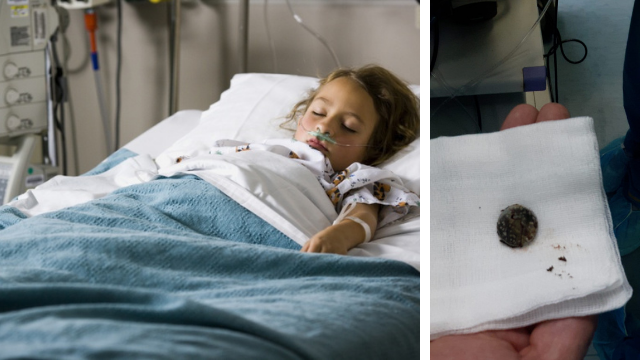 מימין: סוללת הדיסק שהוצאה